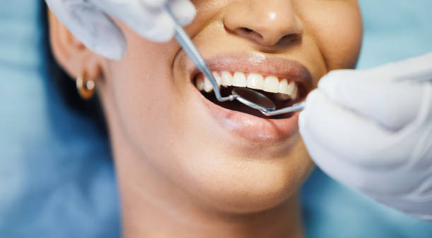 Best Emergency Broken Tooth Repair in Bella Vista, AR
