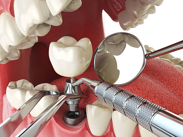 Best Walk-In Emergency Dentist in Bella Vista, AR
